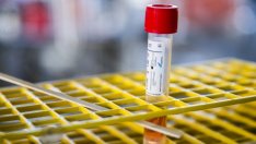 Британският вариант е отговорен за 93% от инфекциите с COVID у нас