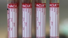 Нови 298 случая на коронавирус у нас при 4884 теста