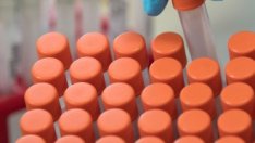 Първи случай на починал лекар от коронавирус у нас, щабът спира брифингите