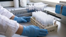 Болници искат МЗ да плаща PCR тестовете при планов прием на пациенти