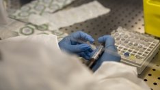 Какво трябва да знаем за маймунската шарка?