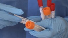 Германия спира безплатните тестове за COVID от 11 октомври