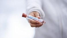 СЗО: Светът трябва да инвестира поне 100 млрд. долара в борбата с пандемията