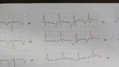 Голямото правителство е добро обяснение за спадащата производителност