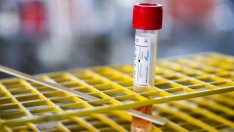 Делта вариантът на COVID-19 доминира на 100% у нас