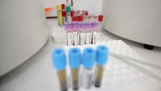 Вирусолог: Да опитаме да приложим лекарството, доказало, че помага и за COVID-19