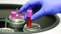 Д-р Асен Балтов: Следващите две седмици ще бъдат критични за Covid-19 у нас