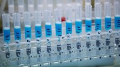 Излекувани от COVID-19 ще се изписват по лекарска преценка или след два PCR теста