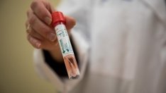 Проф. Иво Петров: България разполага с най-добрата БЦЖ ваксина