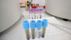 Проф. Иво Петров: Хлорохинът лекува, но е безотговорно за самолечение