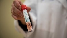 Проф. Н. Витанов: Влизаме в неблагоприятния вариант на пандемията