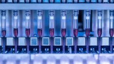 На ден в България се правят около 300-350 теста за коронавирус