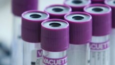 България разглежда всички опции за осигуряване на ваксина за COVID-19