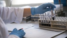 41% от всички потвърдени случаи на коронавирус у нас вече са излекувани