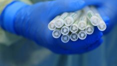 Нови 63 случая на коронавирус в България при 923 теста