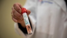 Проф. Г. Начев: Смъртността от коронавирус е около 3,2%, а от грип е 5%