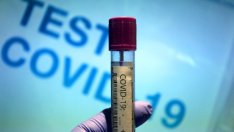 Клъстерът в Сърница вдигна броя на новозаразените с  Covid-19 до 83 за денонощие