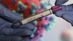 Антирекорд за хоспитализираните с Covid у нас 