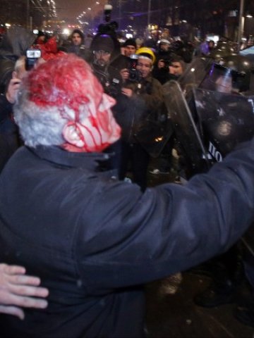 <p>
	Окървавеният Милан Генадиев. Снимка: БТА</p>
