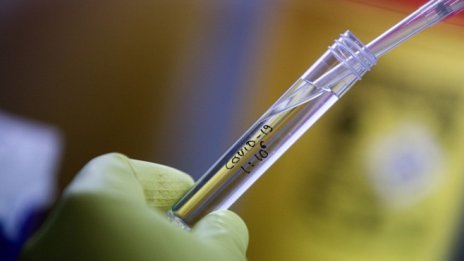 Д-р Спас Спасков: Коронавирусът не е особено опасна инфекция