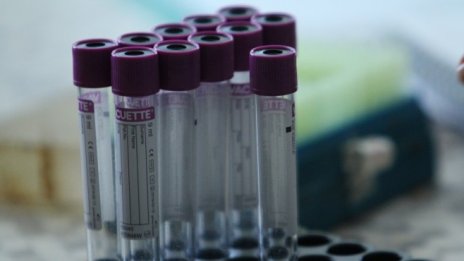 Отново ръст на новите заразени с Covid-19 - 165 при 2896 теста