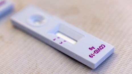 Вирусолог: PCR тестът ще отстъпи пред бързите тестове 