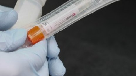 Единствените поскъпващи италиански акции са на производител на тест за COVID-19