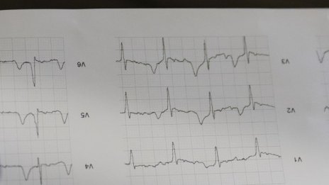 Голямото правителство е добро обяснение за спадащата производителност