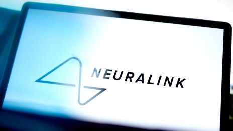 Искате подробности за мозъчния имплант на Neuralink? Ще трябва да попитате самия Мъск