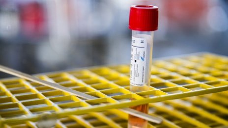 За две седмици омикрон вариантът може да се превърне в напълно доминиращ у нас