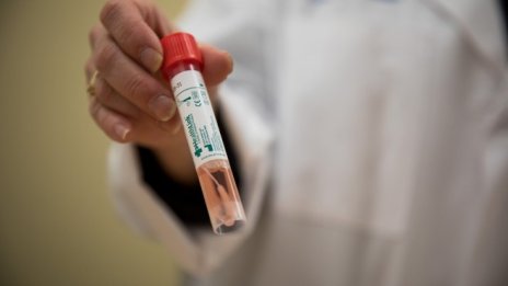 522 са случаите на COVID-19 у нас