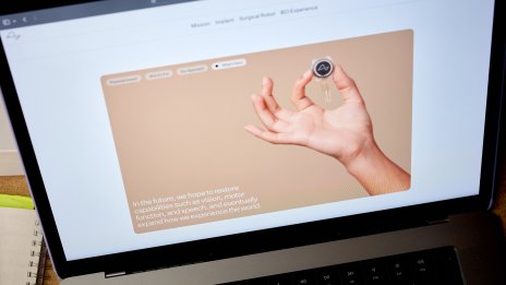 Neuralink ще постави следващия си мозъчен имплант след около седмица