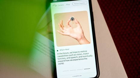 Операцията за поставяне на имплант на Neuralink на втори пациент бе отложена