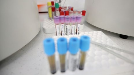 Всички тестове за коронавирус влизат в обща информационна система