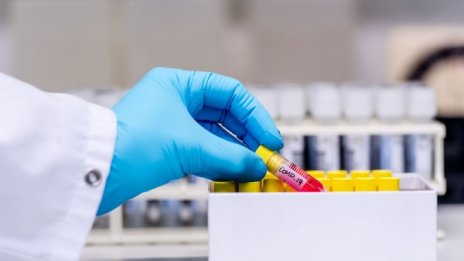 Отпада изискването за отрицателен PCR тест при влизане в Сърбия