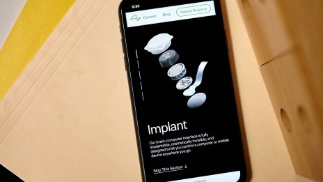 Първият човек с чип на Neuralink игра шах на компютър във видео стрийминг