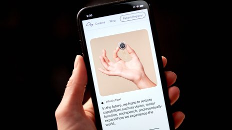 Първият човек с чип на Neuralink може да контролира компютърна мишка с мисълта си