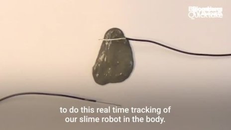 Робот от слуз ще може да прави операции в тялото ви