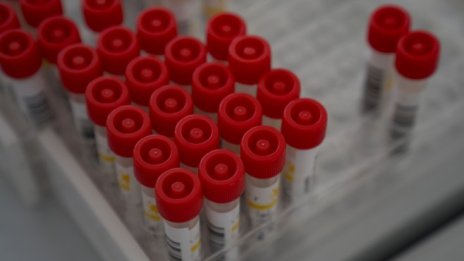 9,35% от новите проби за Covid-19 са положителни