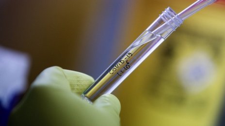 196 са новите случаи на коронавирус при 3686 теста