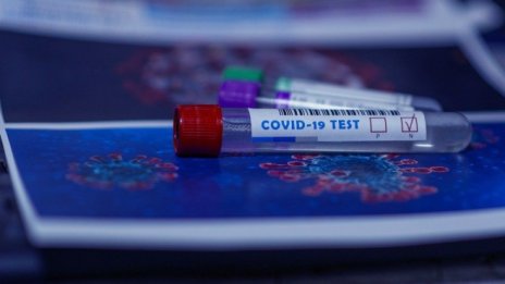 Ще могат ли направленията за PCR тест да се издават електронно? 