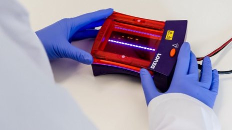 Потвърдените случаи на COVID-19 у нас са 485