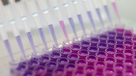 Електронните направления за PCR тестове влизат в системата до дни