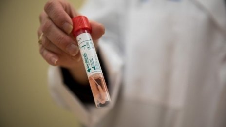 Проф. Йонко Мермерски: Патентовам бърз тест за COVID-19