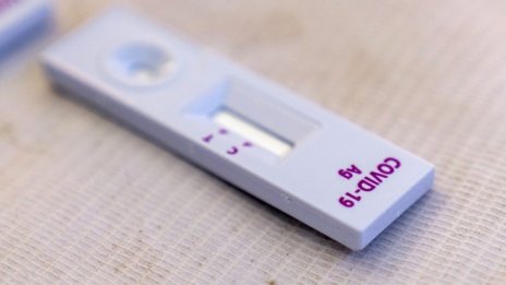 Стартира системата за електронни направления за PCR тест