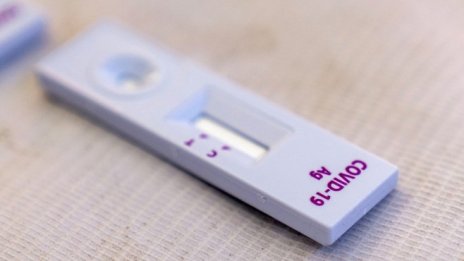 Личните лекари да издават направления за PCR при 2 симптома, предлага НЗОК