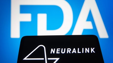 Neuralink е изправена пред федерална проверка и недоволни служители 