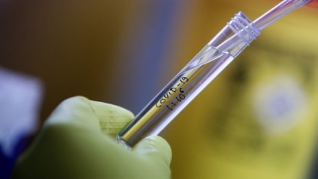 Бързи тестове на 16 производителя ще се признават у нас