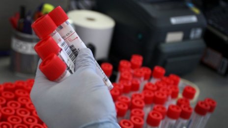 18 души с потвърден коронавирус са починали у нас за денонощие