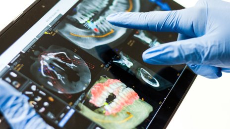 Д-р Бранимир Кирилов: Технологиите ни позволяват да лекуваме с по-малка намеса и по-голям комфорт за пациента